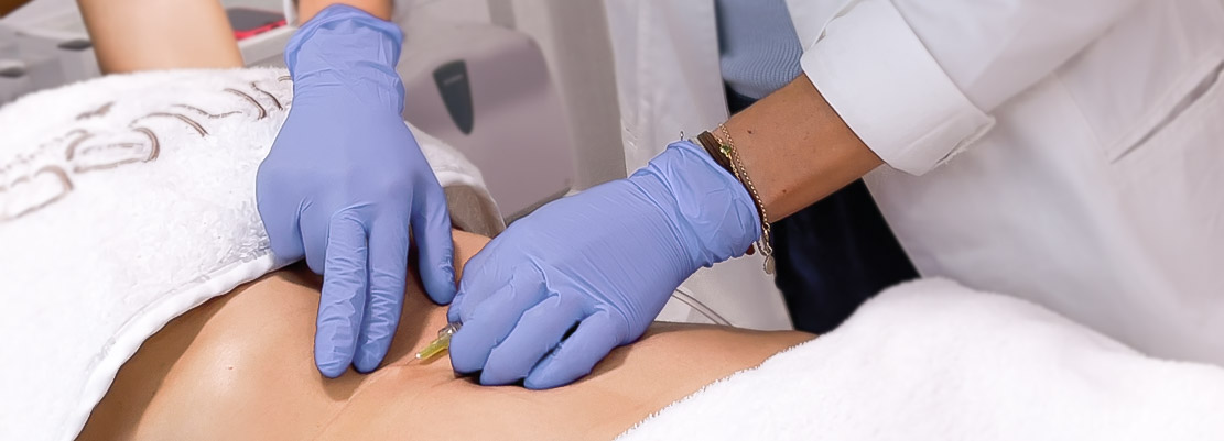 Sesión de carboxiterapia enfocada en eliminar flacidez corporal y activar la circulación para una piel más firme