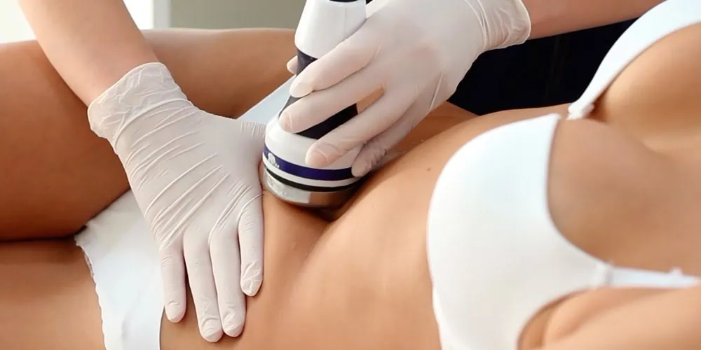 Tratamiento intensivo que integra cavitación, ondas rusas, radiofrecuencia y vacum para esculpir el cuerpo