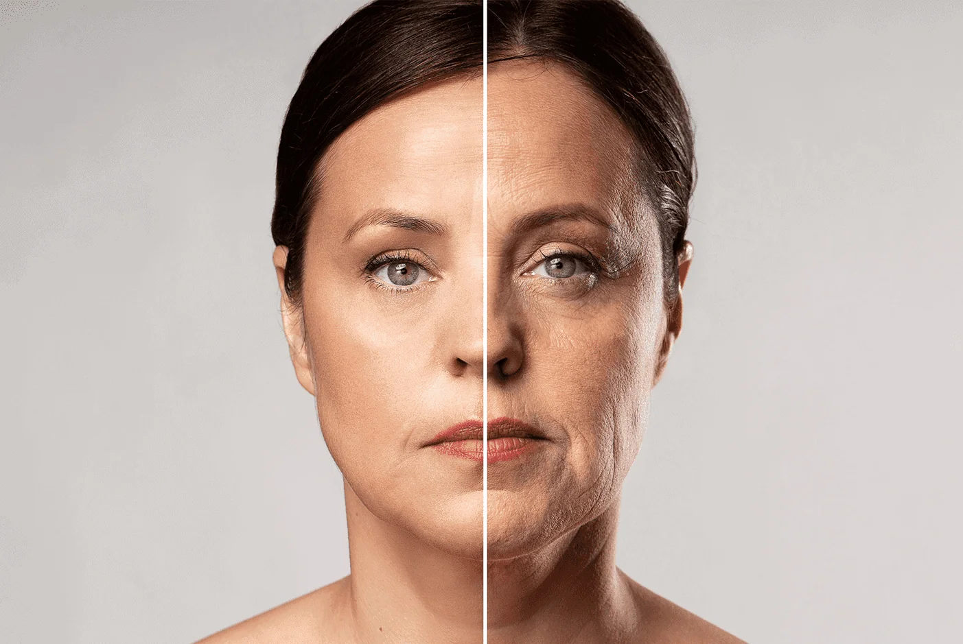 Etrebelle actúa como bioestimulador híbrido, restaurando volumen suave y estimulando colágeno con resultado natural