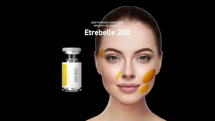 Bioestimulador híbrido Etrebelle que combina ácido hialurónico y agentes estimulantes de colágeno para firmeza facial