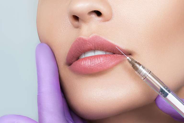 Tratamiento de labios para definir arco de cupido y mejorar hidratación con efecto elegante y sutil