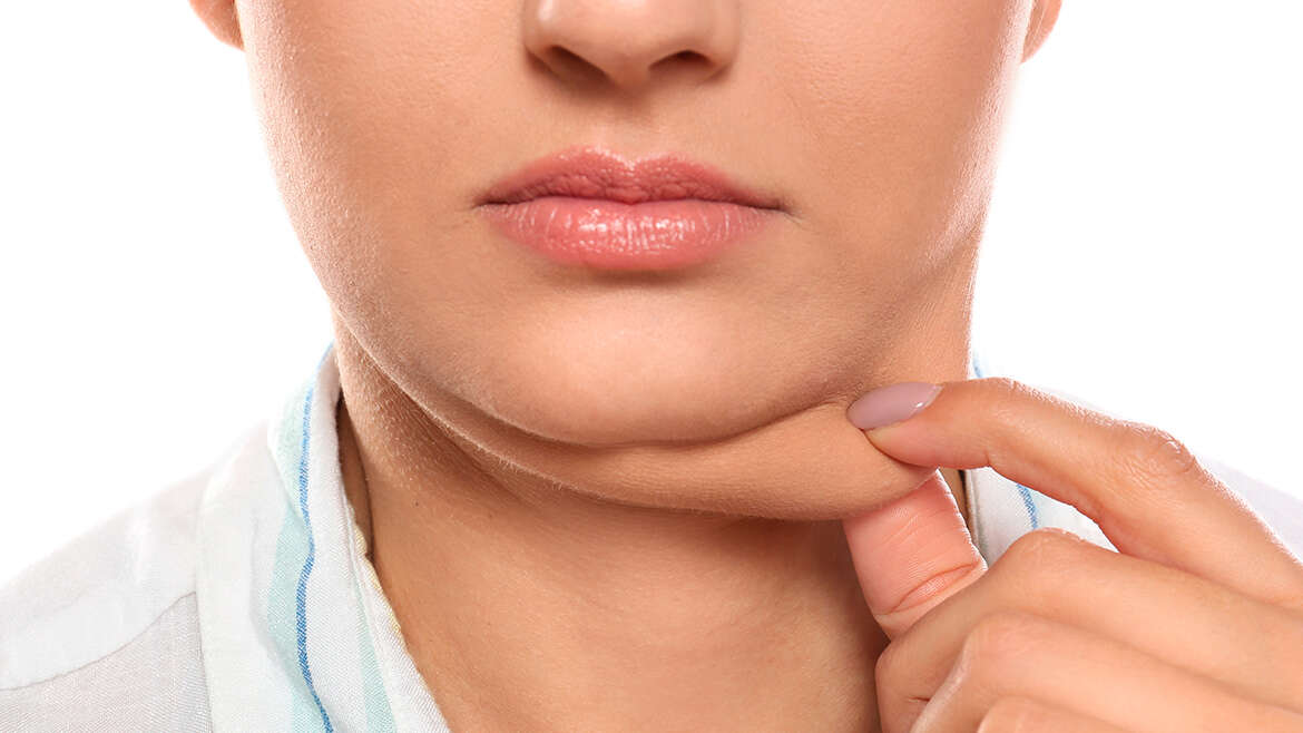 Tratamiento no quirúrgico para reducir papada y mejorar definición del cuello mediante lipólisis enzimática controlada