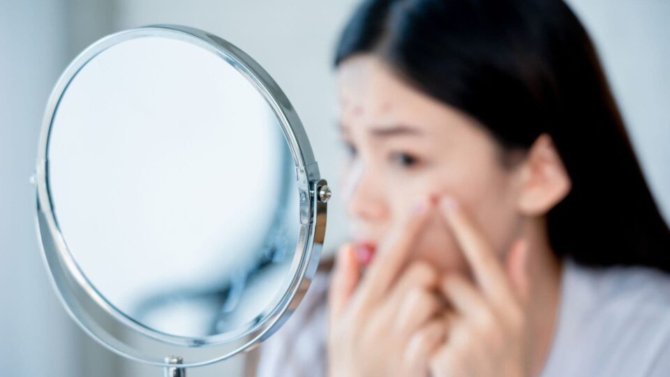 Limpieza y exfoliación antiacné para poros más limpios y piel más uniforme
