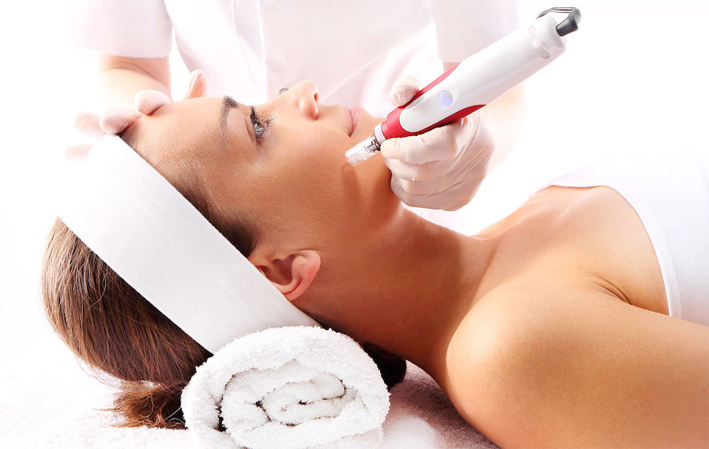 Microneedling Total Skin para revitalizar el rostro y mejorar su apariencia general