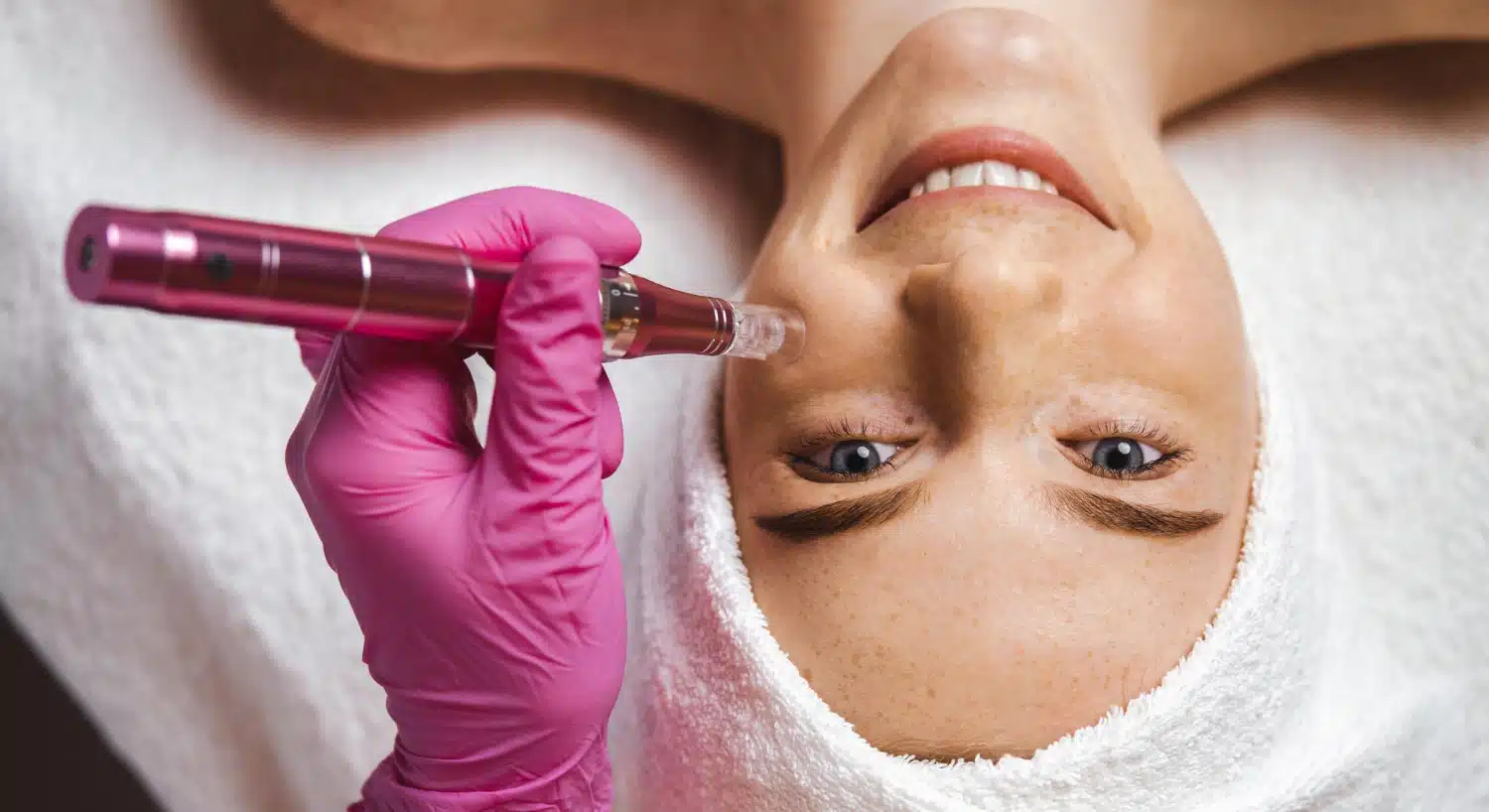 Microneedling Total Skin para estimular colágeno y elastina, mejorando textura y firmeza de la piel