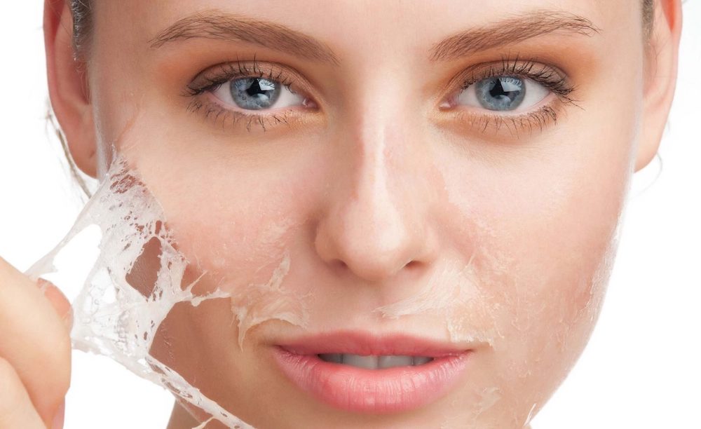 Tratamiento químico controlado para estimular colágeno y elastina