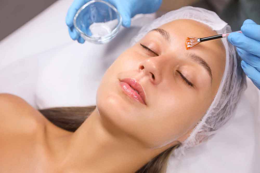 Peeling químico personalizado según tipo de piel y objetivo estético del paciente