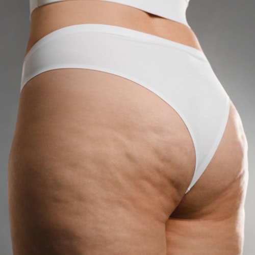 DualPack Anticelulitis Corporal