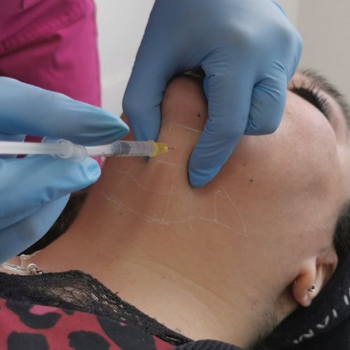 Lipopapada Estética
