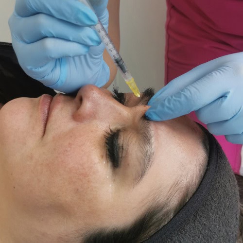 Toxina Botulinica Botox