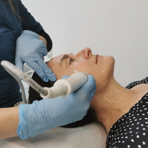 HIFU FaceLift Facial